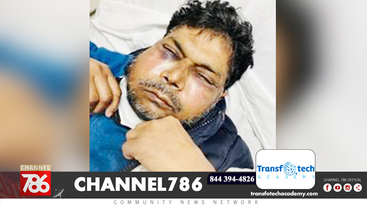 ব্রুকলিনে বাংলাদেশি নুরুল হকের ওপর হামলা ব্রুকলিনে বাংলাদেশি নুরুল হকের ওপর হামলা